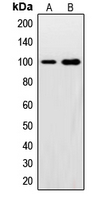 SNCAIP / Synphilin 1 Antibody - Western blot analysis of Synphilin 1 expression in HeLa (A); U2OS (B) whole cell lysates.