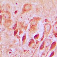 SNCAIP / Synphilin 1 Antibody - Immunohistochemical analysis of Synphilin 1 staining in human brain formalin fixed paraffin embedded tissue section. The section was pre-treated using heat mediated antigen retrieval with sodium citrate buffer (pH 6.0). The section was then incubated with the antibody at room temperature and detected using an HRP conjugated compact polymer system. DAB was used as the chromogen. The section was then counterstained with hematoxylin and mounted with DPX.