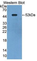 SNCAIP / Synphilin 1 Antibody - Western Blot; Sample: Recombinant protein.