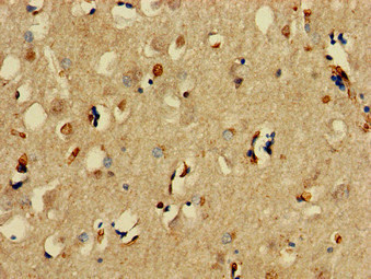 SNCAIP / Synphilin 1 Antibody - Immunohistochemistry of paraffin-embedded human brain tissue at dilution of 1:100