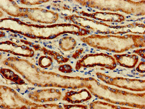 SNCAIP / Synphilin 1 Antibody - Immunohistochemistry of paraffin-embedded human kidney tissue at dilution of 1:100