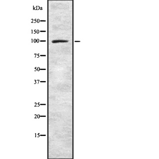 SNCAIP / Synphilin 1 Antibody - Western blot analysis Synphilin-1 using LOVO cells whole cells lysates