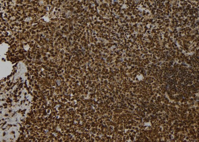 SNCAIP / Synphilin 1 Antibody - 1:100 staining mouse spleen tissue by IHC-P. The sample was formaldehyde fixed and a heat mediated antigen retrieval step in citrate buffer was performed. The sample was then blocked and incubated with the antibody for 1.5 hours at 22°C. An HRP conjugated goat anti-rabbit antibody was used as the secondary.