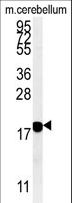 SNCB / Beta-Synuclein Antibody - SNCB Antibody western blot of mouse cerebellum tissue lysates (15 ug/lane). The SNCB antibody detected SNCB protein (arrow).
