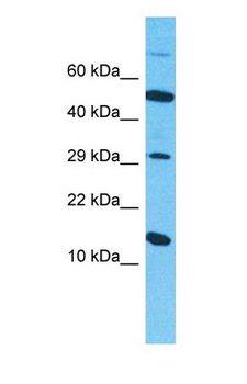 SNCB / Beta-Synuclein Antibody - Western blot of SYUB Antibody with human 786-0 Whole Cell lysate.  This image was taken for the unconjugated form of this product. Other forms have not been tested.