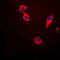 SNCB / Beta-Synuclein Antibody - Immunofluorescent analysis of Beta-synuclein staining in HeLa cells. Formalin-fixed cells were permeabilized with 0.1% Triton X-100 in TBS for 5-10 minutes and blocked with 3% BSA-PBS for 30 minutes at room temperature. Cells were probed with the primary antibody in 3% BSA-PBS and incubated overnight at 4 C in a humidified chamber. Cells were washed with PBST and incubated with a DyLight 594-conjugated secondary antibody (red) in PBS at room temperature in the dark. DAPI was used to stain the cell nuclei (blue).