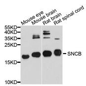 SNCB / Beta-Synuclein Antibody - Western blot analysis of extracts of various cell lines, using SNCB antibody at 1:1000 dilution. The secondary antibody used was an HRP Goat Anti-Rabbit IgG (H+L) at 1:10000 dilution. Lysates were loaded 25ug per lane and 3% nonfat dry milk in TBST was used for blocking. An ECL Kit was used for detection and the exposure time was 30s.