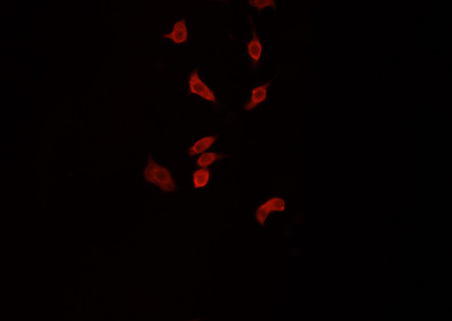 SNCB / Beta-Synuclein Antibody - Staining HeLa cells by IF/ICC. The samples were fixed with PFA and permeabilized in 0.1% Triton X-100, then blocked in 10% serum for 45 min at 25°C. The primary antibody was diluted at 1:200 and incubated with the sample for 1 hour at 37°C. An Alexa Fluor 594 conjugated goat anti-rabbit IgG (H+L) antibody, diluted at 1/600, was used as secondary antibody.