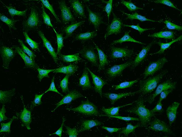 SNCB / Beta-Synuclein Antibody - Immunofluorescence staining of SNCB in HeLa cells. Cells were fixed with 4% PFA, permeabilzed with 0.1% Triton X-100 in PBS, blocked with 10% serum, and incubated with rabbit anti-Human SNCB polyclonal antibody (dilution ratio 1:200) at 4°C overnight. Then cells were stained with the Alexa Fluor 488-conjugated Goat Anti-rabbit IgG secondary antibody (green) and counterstained with DAPI (blue). Positive staining was localized to Cytoplasm.