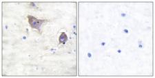 SNCB / Beta-Synuclein Antibody - Peptide - + Immunohistochemical analysis of paraffin-embedded human brain tissue using Synuclein ß antibody.