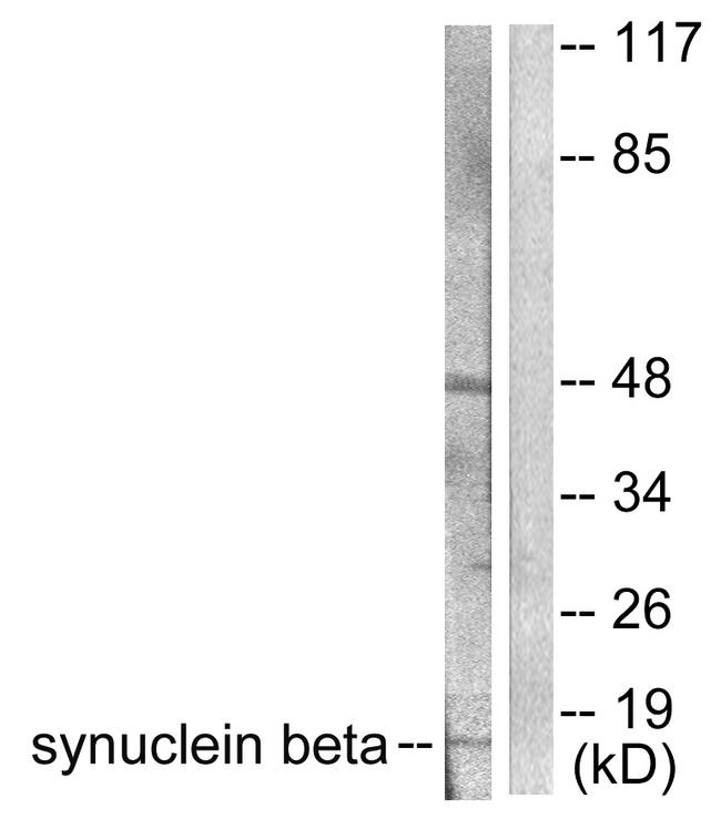 SNCB / Beta-Synuclein Antibody - Western blot analysis of extracts from HeLa cells, using Synuclein ß antibody.