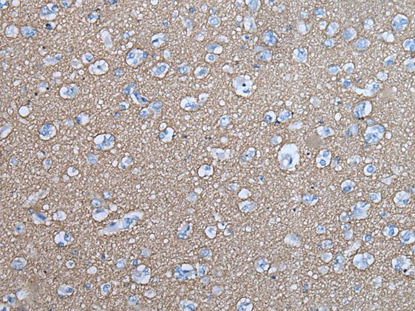 SNCB / Beta-Synuclein Antibody - Immunohistochemistry of paraffin-embedded Human brain tissue  using SNCB Polyclonal Antibody at dilution of 1:45(×200)
