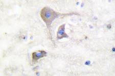 SNCB / Beta-Synuclein Antibody - IHC of Synuclein (S118) pAb in paraffin-embedded human brain tissue.