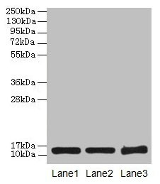 SNCG / Gamma-Synuclein Antibody - Western blot All lanes: Gamma-synuclein antibody at 16µg/ml Lane 1: HT29 whole cell lysate Lane 2: Mouse brain tissue Lane 3: 293T whole cell lysate Secondary Goat polyclonal to rabbit IgG at 1/10000 dilution Predicted band size: 13 kDa Observed band size: 13 kDa