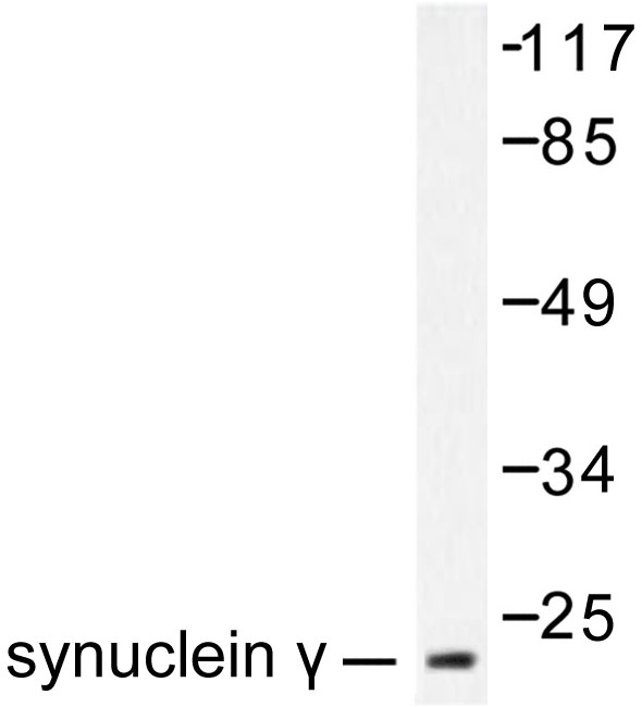 SNCG / Gamma-Synuclein Antibody - Western blot of Synuclein (A111) pAb in extracts from HT29 cells.