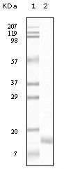 SNCG / Gamma-Synuclein Antibody - gamma Synuclein Antibody in Western Blot (WB)