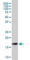SNCG / Gamma-Synuclein Antibody - SNCG monoclonal antibody (M01), clone 2C3. Western Blot analysis of SNCG expression in human spleen.