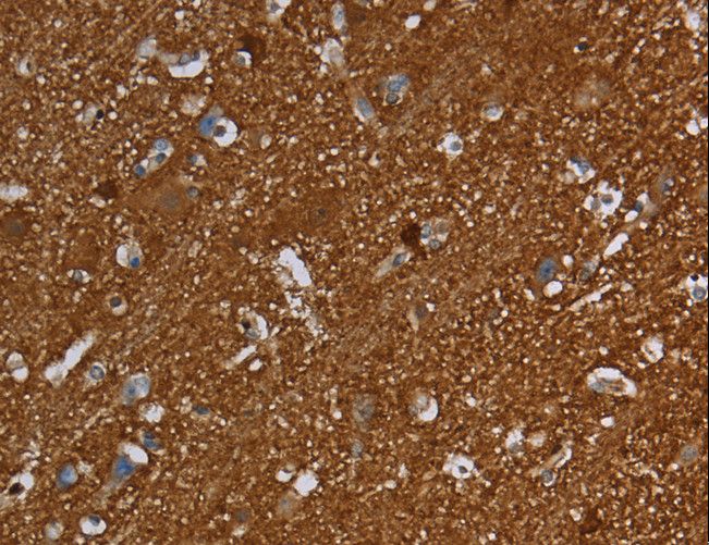 SNCG / Gamma-Synuclein Antibody - Immunohistochemistry of paraffin-embedded Human brain using SNCG Polyclonal Antibody at dilution of 1:60.