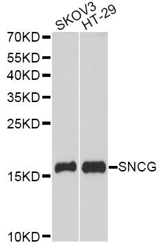 SNCG / Gamma-Synuclein Antibody - Western blot analysis of extracts of various cell lines, using SNCG antibody at 1:3000 dilution. The secondary antibody used was an HRP Goat Anti-Rabbit IgG (H+L) at 1:10000 dilution. Lysates were loaded 25ug per lane and 3% nonfat dry milk in TBST was used for blocking. An ECL Kit was used for detection and the exposure time was 90s.