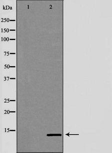 SNCG / Gamma-Synuclein Antibody - Western blot analysis of mouse lung lysate using SNCG antibody. The lane on the left is treated with the antigen-specific peptide.