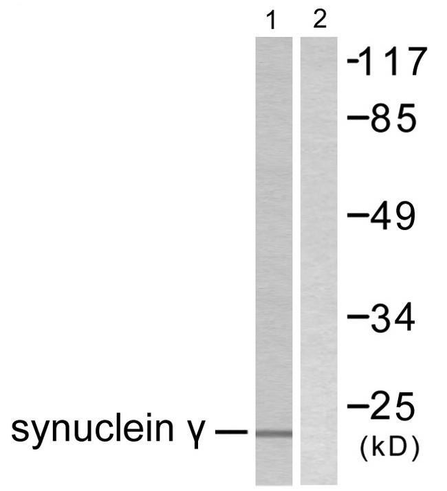 SNCG / Gamma-Synuclein Antibody - Western blot analysis of extracts from HT29 cells, using Synuclein ? Antibody.