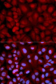 SNCG / Gamma-Synuclein Antibody - Immunofluorescence analysis of U2OS cells using SNCG Polyclonal Antibody.