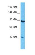 SND1 Antibody - Western blot of SND1 Antibody with human HeLa Whole Cell lysate.  This image was taken for the unconjugated form of this product. Other forms have not been tested.