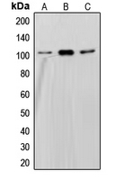 SND1 Antibody - Western blot analysis of SND1 expression in HepG2 (A); Jurkat (B); Ramos (C) whole cell lysates.