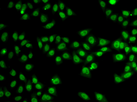 SND1 Antibody - Immunofluorescence analysis of MCF7 cells.