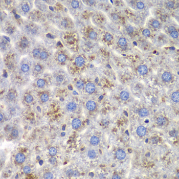 SND1 Antibody - Immunohistochemistry of paraffin-embedded mouse liver using SND1 antibody at dilution of 1:100 (40x lens).