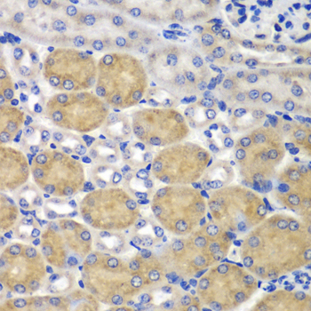 SND1 Antibody - Immunohistochemistry of paraffin-embedded mouse kidney using SND1 antibody at dilution of 1:100 (40x lens).