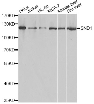 SND1 Antibody - Western blot analysis of extracts of various cell lines, using SND1 antibody at 1:1000 dilution. The secondary antibody used was an HRP Goat Anti-Rabbit IgG (H+L) at 1:10000 dilution. Lysates were loaded 25ug per lane and 3% nonfat dry milk in TBST was used for blocking. An ECL Kit was used for detection and the exposure time was 1s.