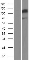 SND1 Protein - Western validation with an anti-DDK antibody * L: Control HEK293 lysate R: Over-expression lysate