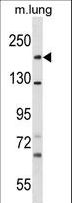 SNED1 Antibody - SNED1 Antibody western blot of mouse lung tissue lysates (35 ug/lane). The SNED1 antibody detected the SNED1 protein (arrow).