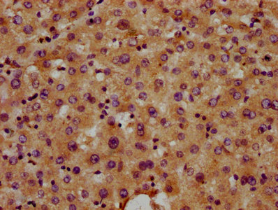 SNED1 Antibody - Immunohistochemistry Dilution at 1:400 and staining in paraffin-embedded human liver tissue performed on a Leica BondTM system. After dewaxing and hydration, antigen retrieval was mediated by high pressure in a citrate buffer (pH 6.0). Section was blocked with 10% normal Goat serum 30min at RT. Then primary antibody (1% BSA) was incubated at 4°C overnight. The primary is detected by a biotinylated Secondary antibody and visualized using an HRP conjugated SP system.
