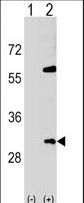 SNF8 / EAP30 Antibody - Western blot of SNF8 (arrow) using rabbit polyclonal SNF8 Antibody. 293 cell lysates (2 ug/lane) either nontransfected (Lane 1) or transiently transfected (Lane 2) with the SNF8 gene.
