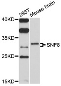 SNF8 / EAP30 Antibody - Western blot analysis of extracts of various cell lines, using SNF8 antibody at 1:1000 dilution. The secondary antibody used was an HRP Goat Anti-Rabbit IgG (H+L) at 1:10000 dilution. Lysates were loaded 25ug per lane and 3% nonfat dry milk in TBST was used for blocking. An ECL Kit was used for detection and the exposure time was 30s.