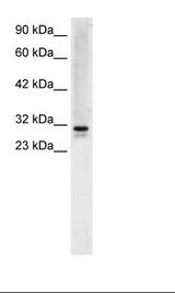 SNF8 / EAP30 Antibody - HepG2 Cell Lysate.  This image was taken for the unconjugated form of this product. Other forms have not been tested.
