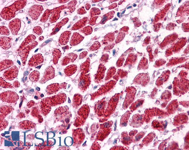 SNF8 / EAP30 Antibody - Anti-SNF8 / EAP30 antibody IHC of human heart. Immunohistochemistry of formalin-fixed, paraffin-embedded tissue after heat-induced antigen retrieval. Antibody concentration 5 ug/ml.  This image was taken for the unconjugated form of this product. Other forms have not been tested.