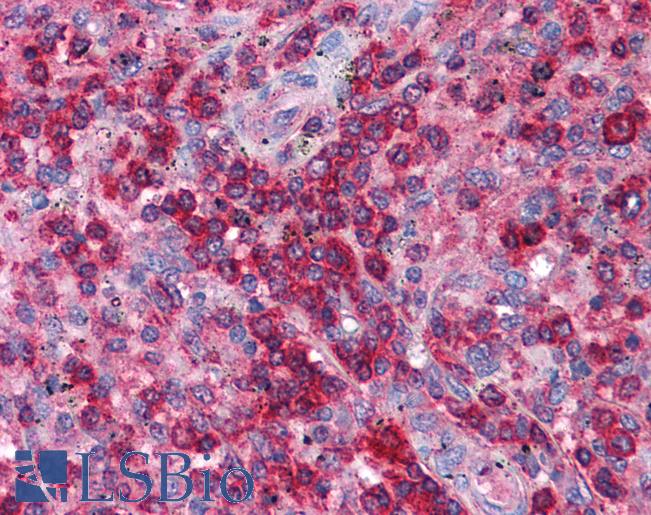 SNF8 / EAP30 Antibody - Anti-SNF8 / EAP30 antibody IHC of human spleen. Immunohistochemistry of formalin-fixed, paraffin-embedded tissue after heat-induced antigen retrieval. Antibody concentration 5 ug/ml.  This image was taken for the unconjugated form of this product. Other forms have not been tested.