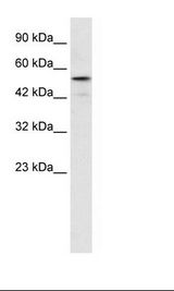 SNIP1 Antibody - Jurkat Cell Lysate.  This image was taken for the unconjugated form of this product. Other forms have not been tested.