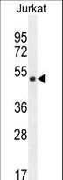 SNIP1 Antibody - SNIP1 Antibody western blot of Jurkat cell line lysates (35 ug/lane). The SNIP1 antibody detected the SNIP1 protein (arrow).