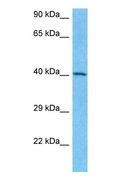 SNIP1 Antibody - Western blot of SNIP1 Antibody with human Jurkat Whole Cell lysate.  This image was taken for the unconjugated form of this product. Other forms have not been tested.