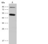 SNIP1 Antibody - Anti-SNIP1 rabbit polyclonal antibody at 1:500 dilution. Lane A: Jurkat Whole Cell Lysate. Lysates/proteins at 30 ug per lane. Secondary: Goat Anti-Rabbit IgG (H+L)/HRP at 1/10000 dilution. Developed using the ECL technique. Performed under reducing conditions. Predicted band size: 46 kDa. Observed band size: 52 kDa.