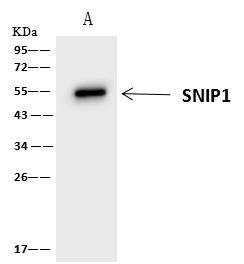 SNIP1 Antibody - SNIP1 was immunoprecipitated using: Lane A: 0.5 mg Jurkat Whole Cell Lysate. 4 uL anti-SNIP1 rabbit polyclonal antibody and 60 ug of Immunomagnetic beads Protein A/G. Primary antibody: Anti-SNIP1 rabbit polyclonal antibody, at 1:100 dilution. Secondary antibody: Clean-Blot IP Detection Reagent (HRP) at 1:1000 dilution. Developed using the ECL technique. Performed under reducing conditions. Predicted band size: 46 kDa. Observed band size: 50 kDa.