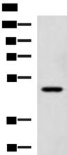 SNIP1 Antibody - Western blot analysis of TM4 cell lysate  using SNIP1 Polyclonal Antibody at dilution of 1:1150