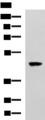 SNIP1 Antibody - Western blot analysis of TM4 cell lysate  using SNIP1 Polyclonal Antibody at dilution of 1:1000