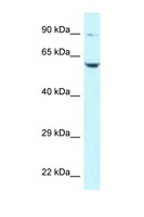 SNK / PLK2 Antibody - PLK2 antibody Western blot of Jurkat Cell lysate. Antibody concentration 1 ug/ml.  This image was taken for the unconjugated form of this product. Other forms have not been tested.