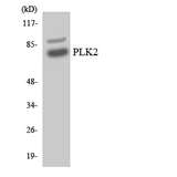 SNK / PLK2 Antibody - Western blot analysis of the lysates from HeLa cells using PLK2 antibody.