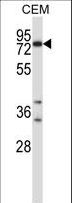 SNK / PLK2 Antibody - Mouse Plk2 Antibody western blot of CEM cell line lysates (35 ug/lane). The Plk2 antibody detected the Plk2 protein (arrow).